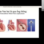 Mất Răng và Làm Răng Giả – BS Nha Khoa Chánh Việt