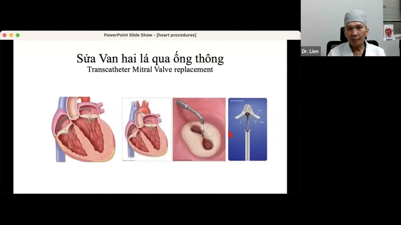Bệnh Hở Valves Tim với bác sĩ John Hậu Liên MD